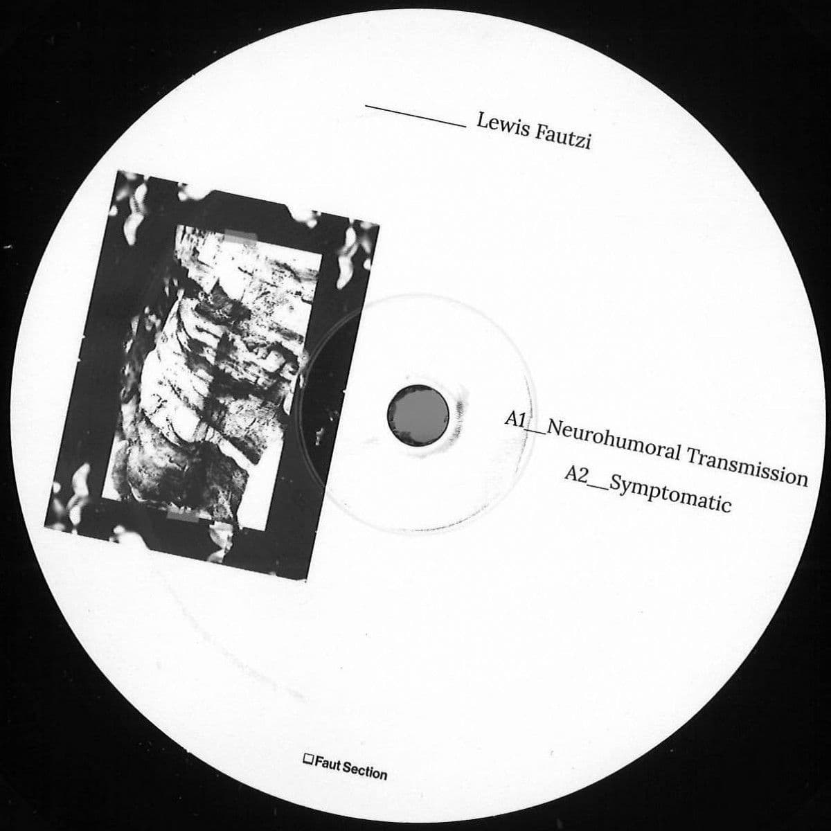 Neurohumoral Transmission EP